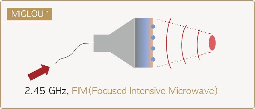 MIGLOU™ FIM energy distribution
